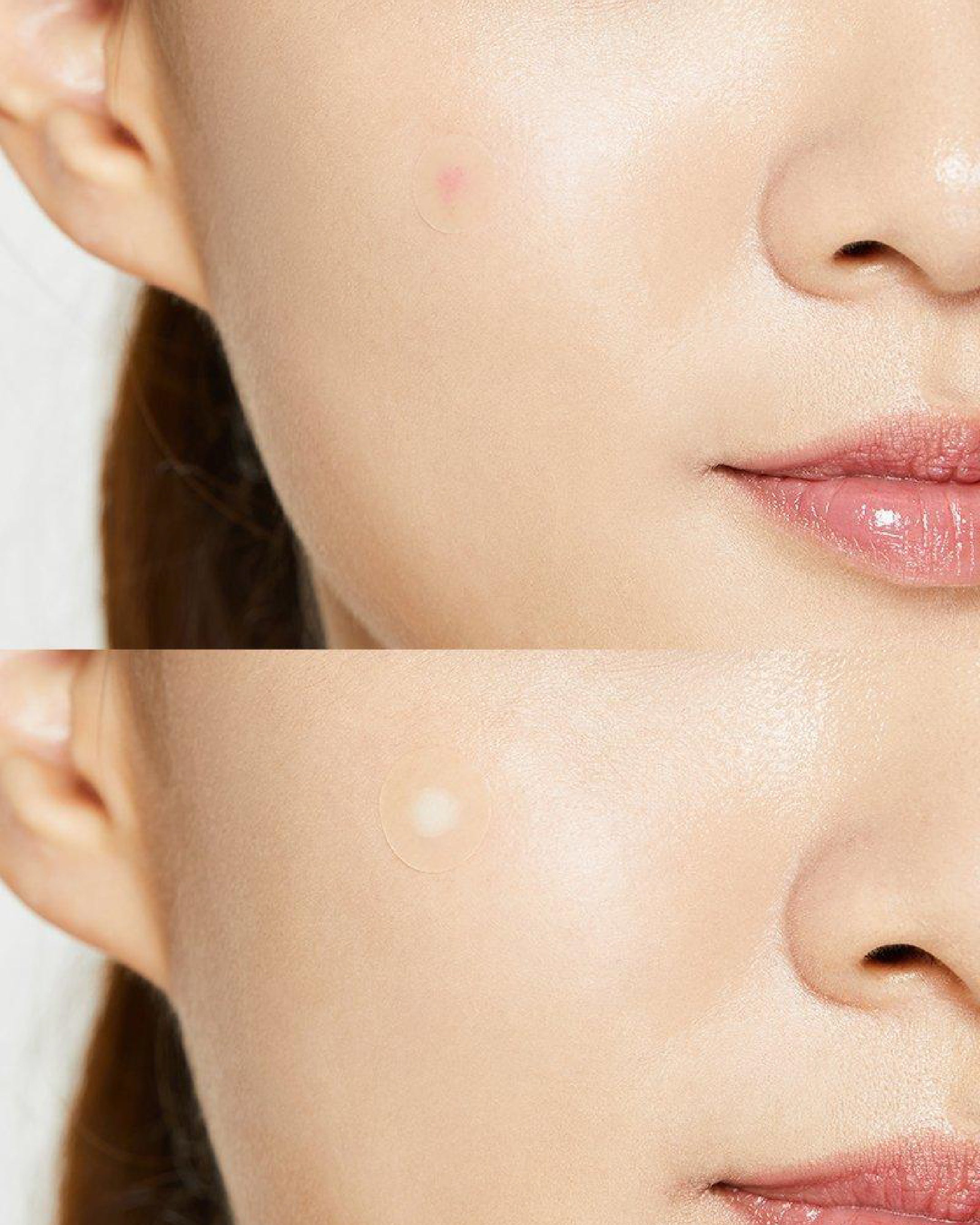 Cosrx Acne Pimple Master Patch (24EA) - Sivilce Bandı - Akne Söndürücü Şeffaf Bant (24'lü)
